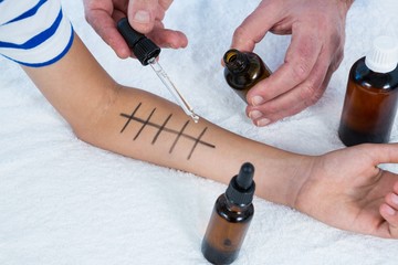 Doctor performing allergy test on skin