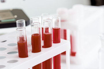 blood in glass tubes on background of microscope