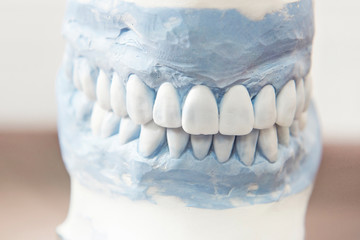 beautiful human teeth (upper and lower jaw teeth, the layout of © elixirfoto