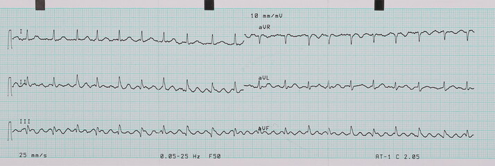 EKG printout background and texture