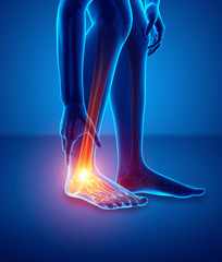 Male foot with ankle pain