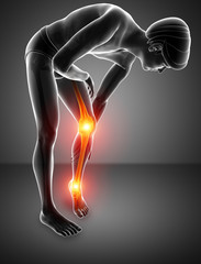 Pain in leg