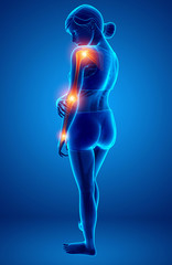 Women Feeling Arm joint pain