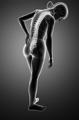 Women Feeling the Back pain