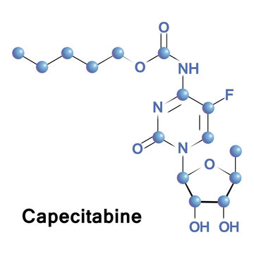 Capecitabine is a chemotherapy medication used to treat breast, gastric and colorectal cancer. It is metabolised to 5-FU which in turn is a thymidylate synthase inhibitor