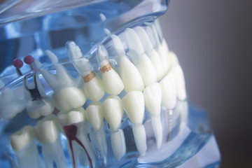 Dental teeth dentistry model