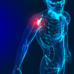 3d render of a medical image with painful shoulder,elbow and spi