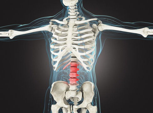 Raggi X scheletro con infiammazione