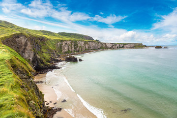 Carrick-a-Rede, Causeway Coast