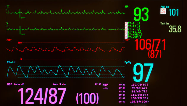 Monitor with black screen showing atrial flutter on green lines, arterial blood pressure on red line, oxygen saturation on blue line, noninvasive blood pressure in fuchsia and temperature.