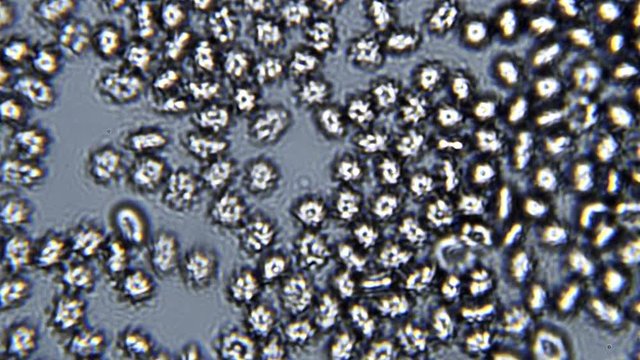 Footage on the theme blood, diseases, interstitial fluid, bacterial background, research using a microscope at extreme magnification of about 1000x