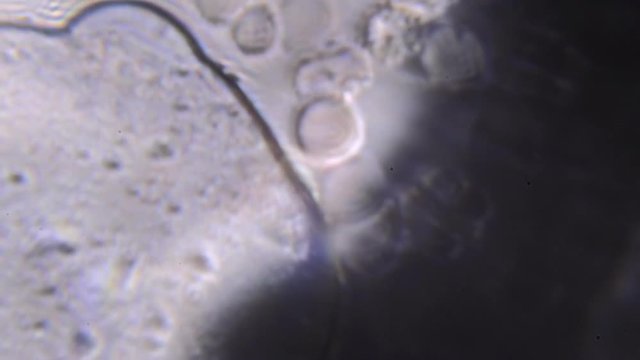 Footage on the theme blood, diseases, interstitial fluid, bacterial background, research using a microscope at extreme magnification of about 1000x