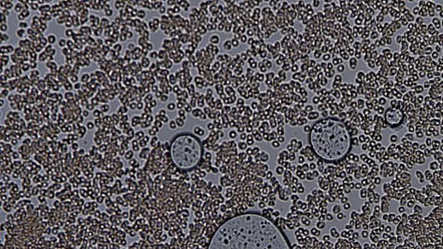 Footage on the theme blood, diseases, interstitial fluid, bacterial background, research using a microscope at  magnification of about 400x
