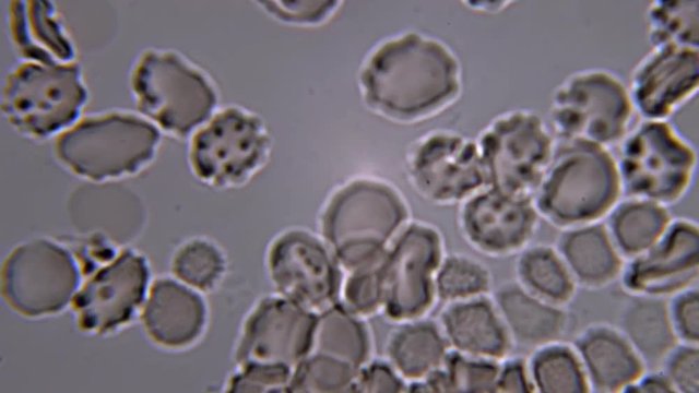 Footage on the theme blood, diseases, interstitial fluid, bacterial background, research using a microscope at extreme magnification of about 1000x