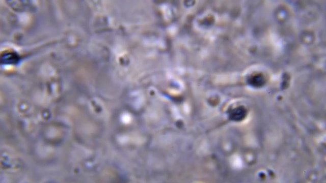 Seeing sperm activity using a microscope at extreme magnification about 1000x