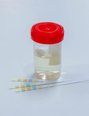 Urine sample