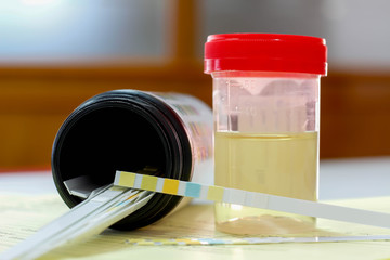 Urine sample