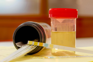 Urine sample