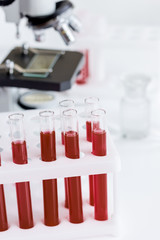 blood in glass tubes on background of microscope