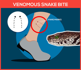 Obraz premium Venomous snake bite in the leg. Snakebite. Beware of snakes. Flat vector illustrations