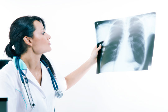 Young female doctor looking at the x-ray picture of lungs in hospital.
