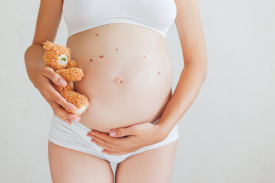 Pregnant woman with many birthmarks (nevus)  in white underwear with toy bear. Young woman expecting a baby.