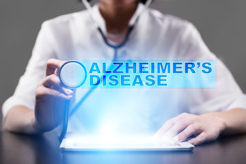 alzheimer?s disease. medical concept.