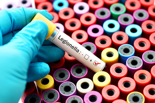 Legionella positive