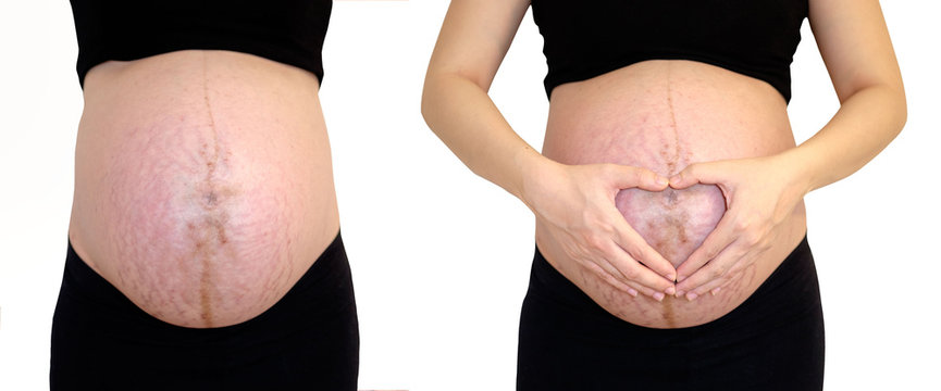 Pregnant woman 40 weeks, Pregnant, Close up of a cute pregnant belly, Isolate and Clipping Path