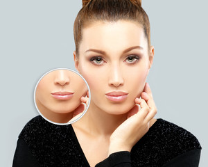 Beauty injections.Concept of rejuvenation.Lip augmentation