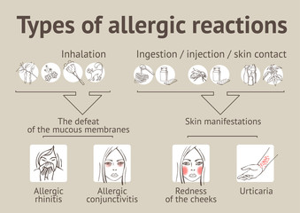 Types of allergic reactions. Scheme