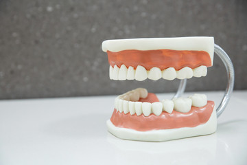 Upper and lower jaw dental model