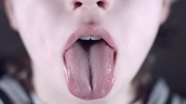 4k Close Up Child Showing his Tongue to Doctor