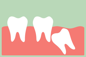 dental cartoon vector, wisdom tooth