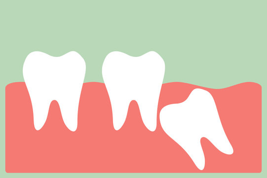 dental cartoon vector, wisdom tooth