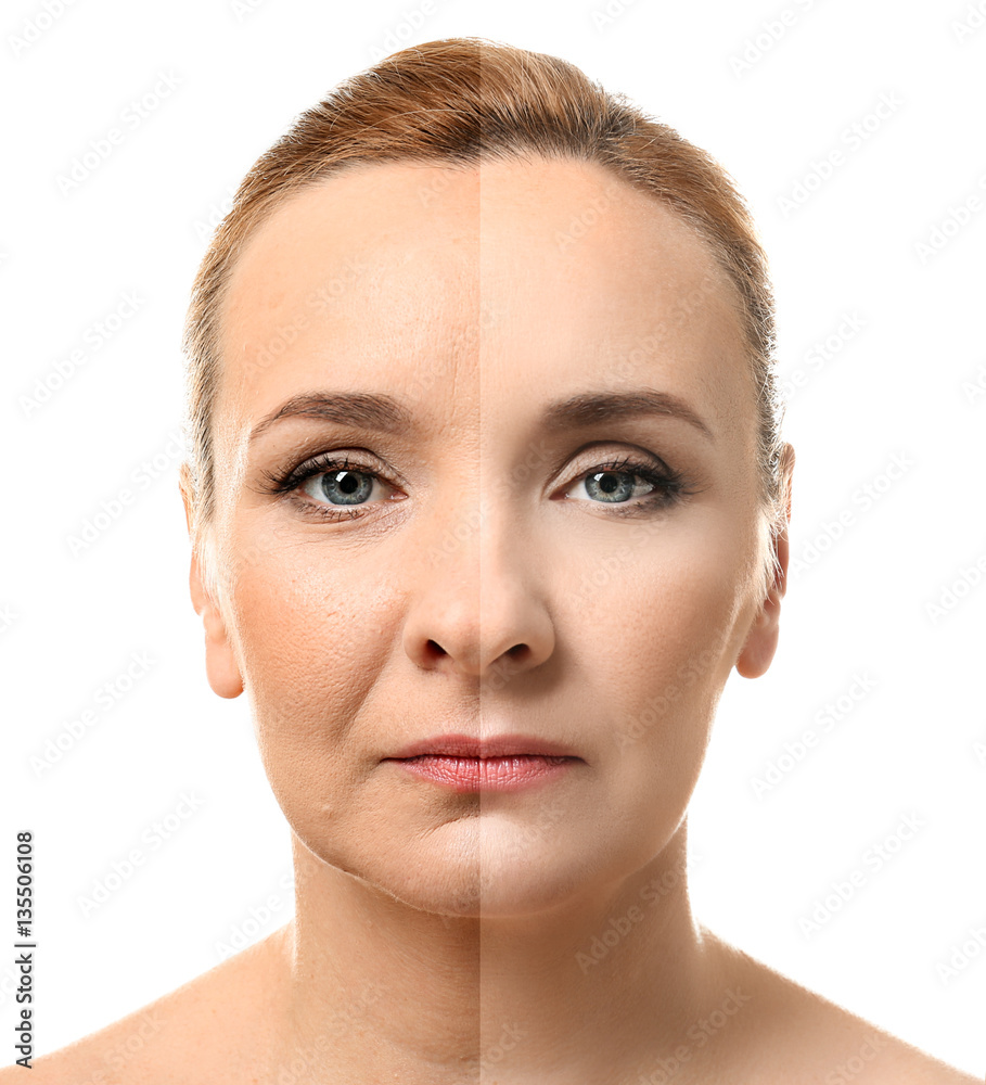 Wall mural Mature woman face before and after cosmetic procedure. Plastic surgery concept.