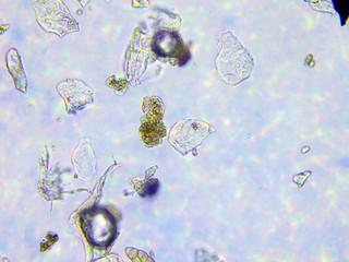 Dust and microorganisms microscopic view x400 magnification