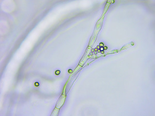 Mold microscopic view x400 magnification