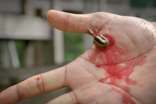 Leeches sucking bloods on bleeding palm