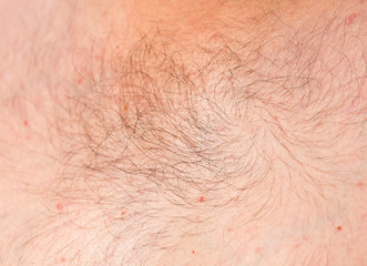 Fototapeta premium the hair on the human skin as background