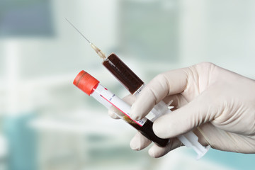 Hand mit Blutprobe und Spritze zur Blutentnahme