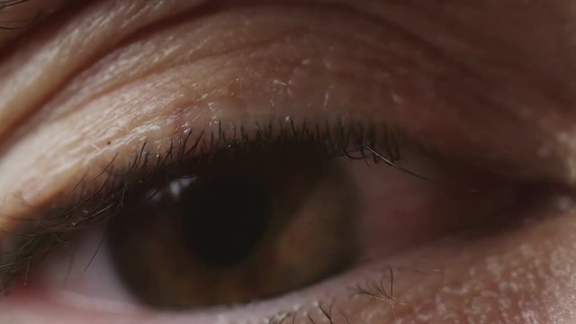 Macro shot focusing on eyelids as eye opens to reveal bloodshot dilated eyeball