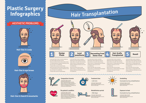 Vector Illustrated Set With Hair Transplant Surgery