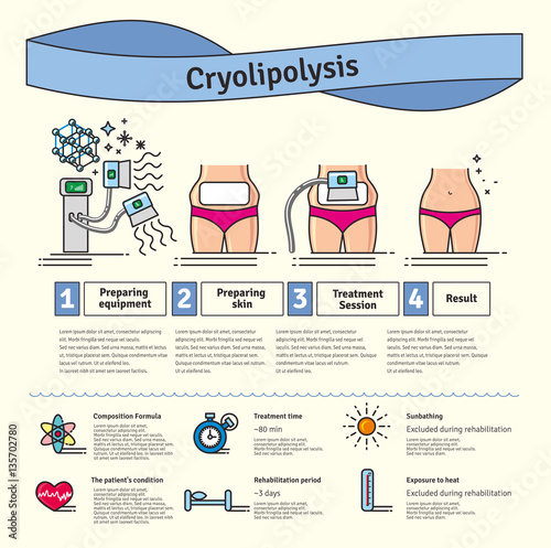 cryolipolysis treatment cryolipolysis treatment