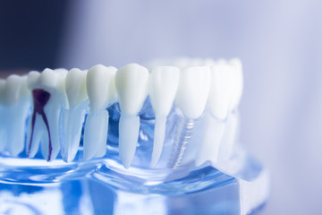 Dental tooth root model