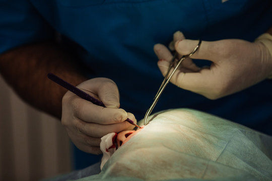 surgeon putting on stitches during cosmetic plastic surgery