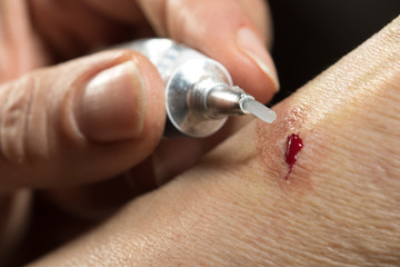 First aid, disinfecting antibiotic cream