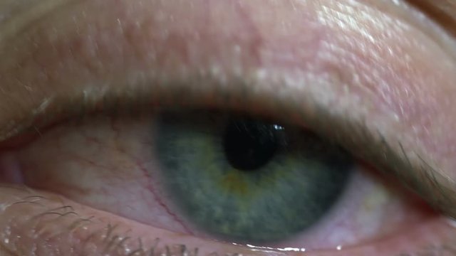 Macro shot of a woman's green eye looking tired and bloodshot 