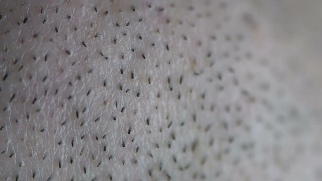 Extreme closeup of a young males facial stubble