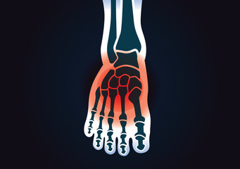 Human foot bone have a red signal. This illustration about foot pain.